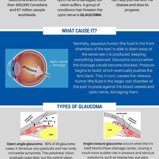 What is Glaucoma?